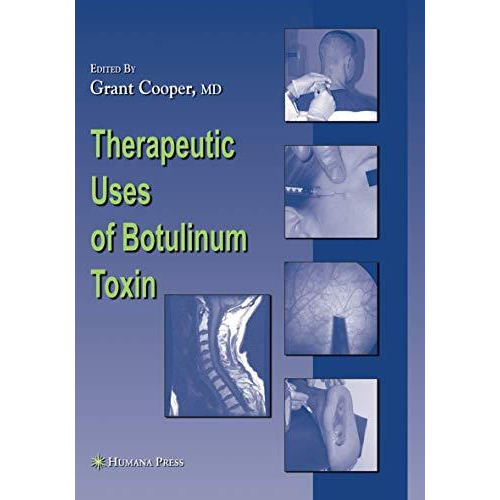 Therapeutic Uses of Botulinum Toxin [Hardcover]