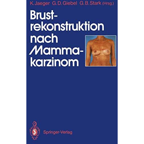 Brustrekonstruktion nach Mammakarzinom [Paperback]