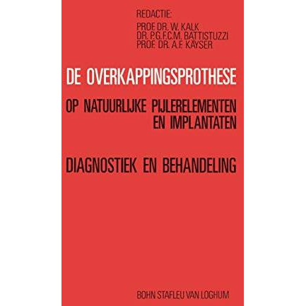 De overkappingsprothese: Diagnostiek en behandeling [Paperback]