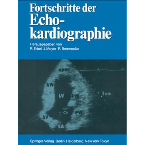 Fortschritte der Echokardiographie [Paperback]