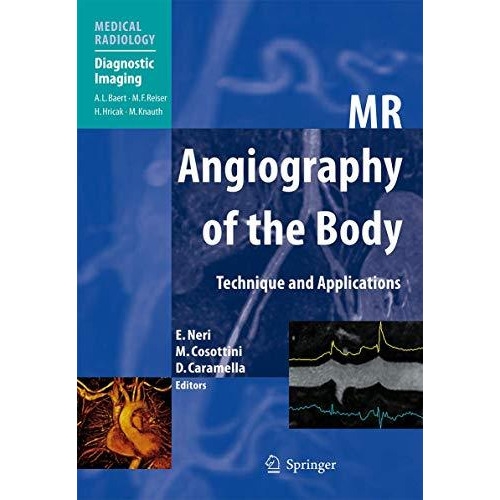 MR Angiography of the Body: Technique and Clinical Applications [Hardcover]