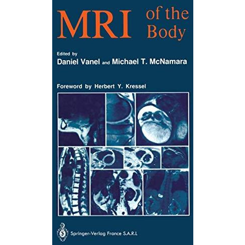 MRI of the Body [Paperback]