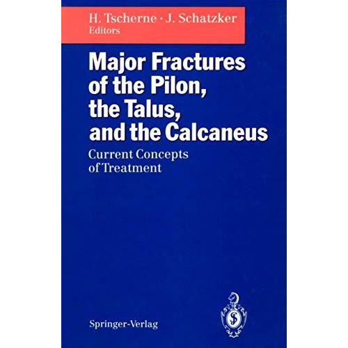 Major Fractures of the Pilon, the Talus, and the Calcaneus: Current Concepts of  [Paperback]