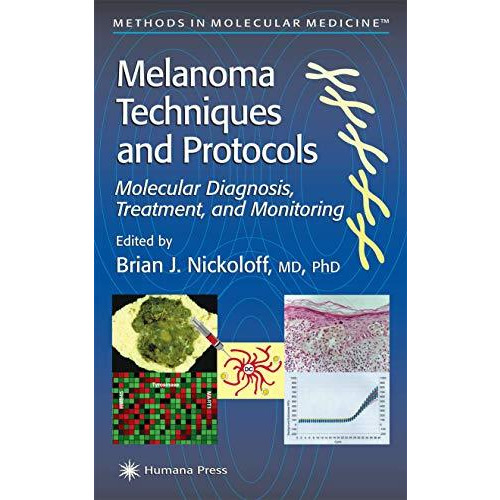 Melanoma Techniques and Protocols: Molecular Diagnosis, Treatment, and Monitorin [Hardcover]