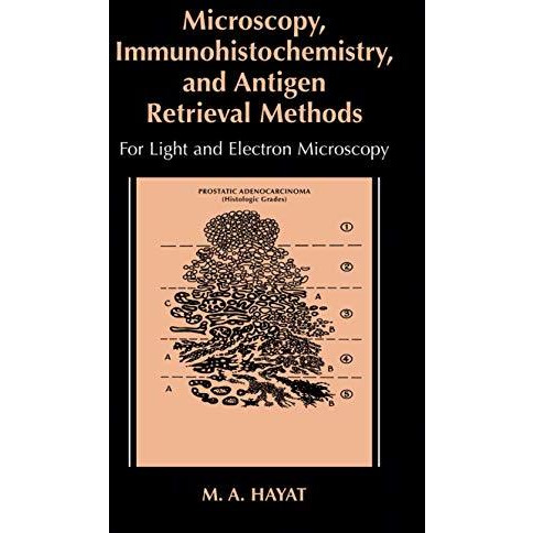 Microscopy, Immunohistochemistry, and Antigen Retrieval Methods: For Light and E [Hardcover]