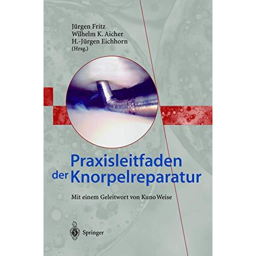 Praxisleitfaden der Knorpelreparatur [Paperback]