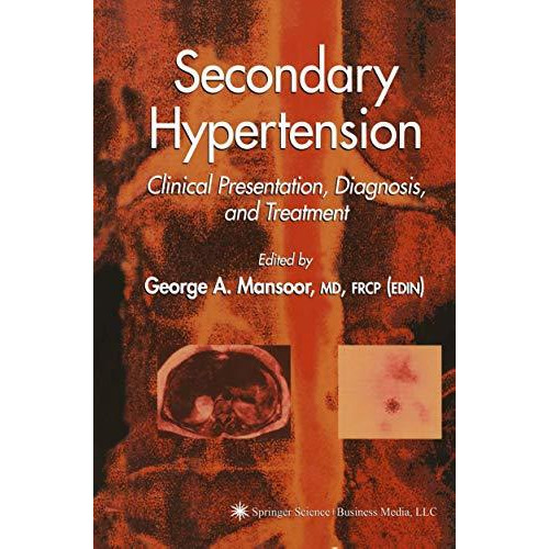 Secondary Hypertension: Clinical Presentation, Diagnosis, and Treatment [Paperback]