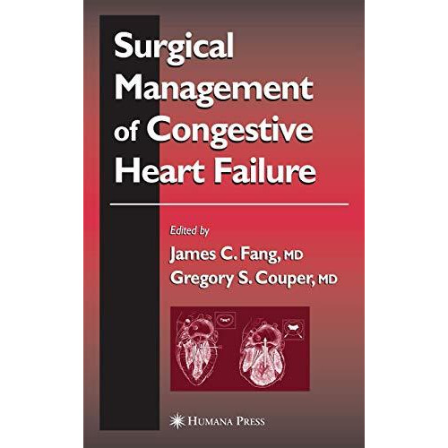 Surgical Management of Congestive Heart Failure [Paperback]