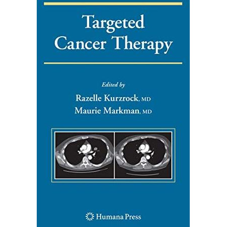 Targeted Cancer Therapy [Hardcover]