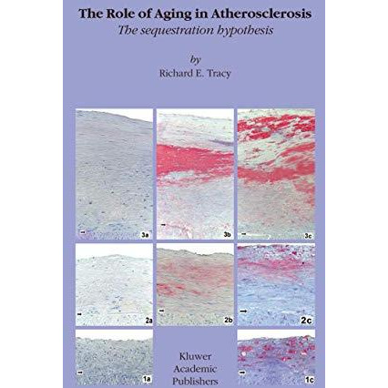 The Role of Aging in Atherosclerosis: The Sequestration Hypothesis [Hardcover]