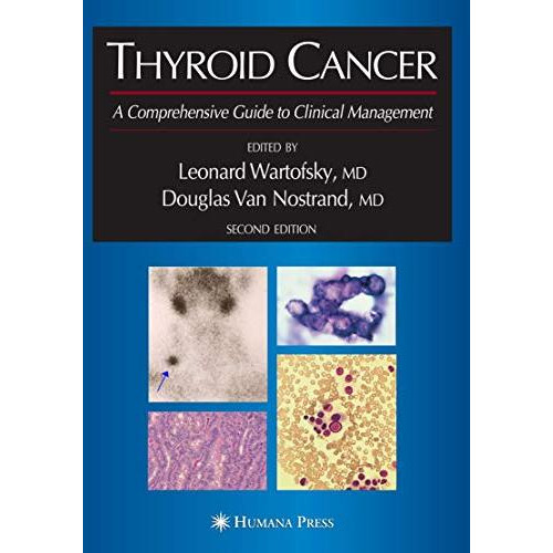 Thyroid Cancer: A Comprehensive Guide to Clinical Management [Paperback]