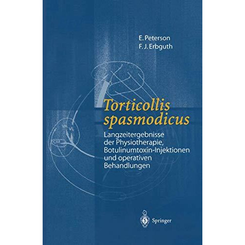 Torticollis spasmodicus: Langzeitergebnisse der Physiotherapie, Botulinumtoxin-I [Paperback]