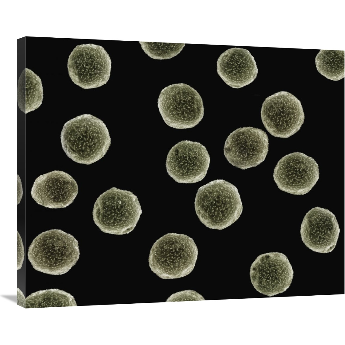 Pollen grains of a Pellitory at 1050x magnification-Canvas Art-35&quotx28"