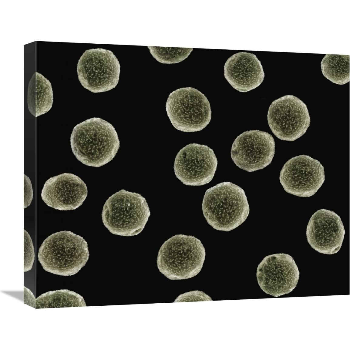 Pollen grains of a Pellitory at 1050x magnification-Canvas Art-24&quotx20"